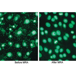 Mycoplasma Removal Agent (MRA) for mycoplasma contamination in cell cultures