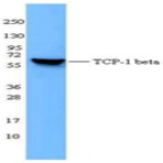 Purified anti-TCP-1beta