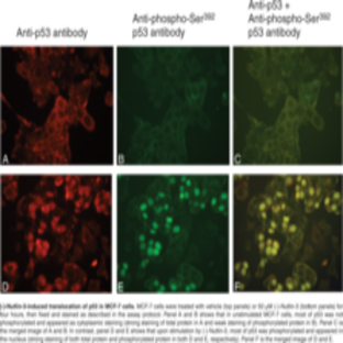 p53 Total and p53 (Phospho-Ser392) Dual Staining Assay Kit