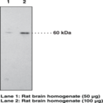 CB1 Receptor Polyclonal Antibody