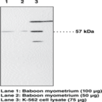 PPAR(alpha) Polyclonal Antibody