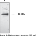 EP3 Receptor Polyclonal Antibody