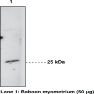 Prostaglandin D Synthase (hematopoietic-type) Polyclonal Antibody