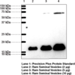 Prostaglandin E Synthase-1 (microsomal) Polyclonal Antibody