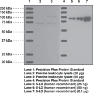 5-Lipoxygenase Polyclonal Antibody