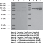 5-Lipoxygenase Polyclonal Antibody