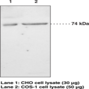 iPLA2 (Type VI) Polyclonal Antibody