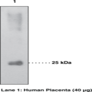 15-hydroxy Prostaglandin Dehydrogenase Polyclonal Antibody