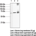 Guanylate Cyclase (beta)1 subunit (soluble) Polyclonal Antibody