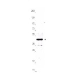 Anti-ha-tag_antibody_biotin_original_600-406-384-ha-epitope-tag-antibody-biotin-conjugated-1-wb-4x3