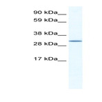 anti-Spi-C Transcription Factor (Spi-1/PU.1 Related) (SPIC) (N-Term) antibody