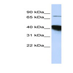 anti-KIAA0427 (KIAA0427) (N-Term) antibody