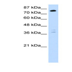 anti-TSC22 Domain Family, Member 2 (TSC22D2) (C-Term) antibody