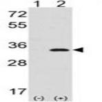 anti-Cyclin-Dependent Kinase 1 (CDK1) (N-Term) antibody