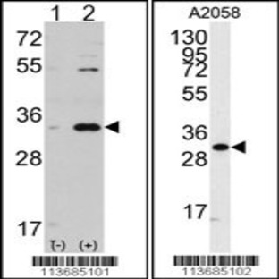 anti-Cyclin-Dependent Kinase 1 (CDK1) (C-Term), (AA 213-241) antibody