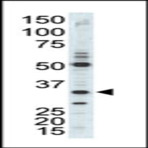 anti-Cyclin-Dependent Kinase 1 (CDK1) (C-Term), (AA 230-260) antibody
