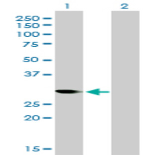 anti-Cyclin-Dependent Kinase 1 (CDK1) (AA 1-298) antibody