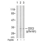 anti-Cyclin-Dependent Kinase 1 (CDK1) (pThr161) antibody