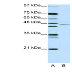 anti-Tripartite Motif Containing 14 (TRIM14) (N-Term) antibody