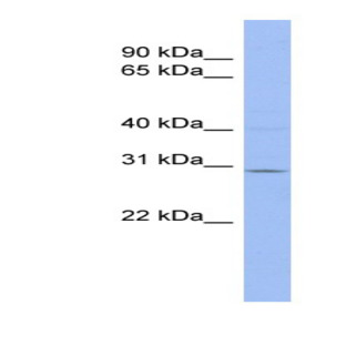 anti-Tripartite Motif Containing 14 (TRIM14) (Middle Region) antibody
