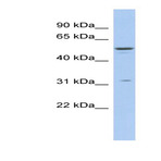 anti-Tripartite Motif Containing 14 (TRIM14) (Middle Region) antibody
