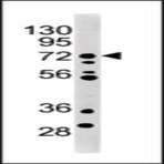 anti-Maternal Embryonic Leucine Zipper Kinase (MELK) (AA 201-230), (Center) antibody
