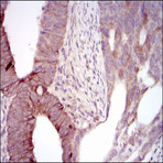 anti-Maternal Embryonic Leucine Zipper Kinase (MELK) (AA 637-651) antibody