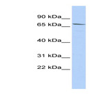 anti-Maternal Embryonic Leucine Zipper Kinase (MELK) (Middle Region) antibody