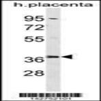 Anti-proteasome_prosome_macropain_26s_subunit_non-atpase_6_psmd6_center_aa_154-182_antibody_original_ap20266c_wb_1