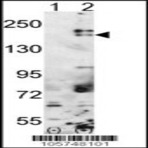 anti-SET Domain, Bifurcated 1 (SETDB1) (C-Term), (AA 1193-1225) antibody