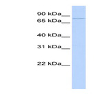 anti-Zinc Finger and BTB Domain Containing 39 (ZBTB39) (Middle Region) antibody