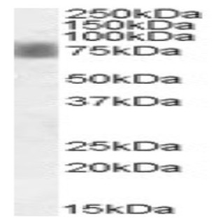 anti-NUAK Family, SNF1-Like Kinase, 1 (NUAK1) (Internal Region) antibody