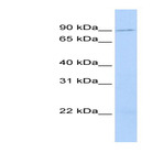anti-Transmembrane and Coiled-Coil Domain Family 2 (TMCC2) (N-Term) antibody