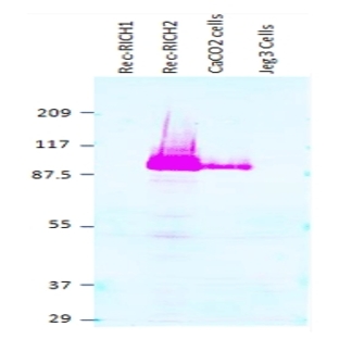 anti-rho GTPase Activating Protein 44 (ARHGAP44) (N-Term), (AA 1-60) antibody