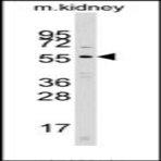 anti-Cell Division Cycle 25 Homolog A (S. Pombe) (CDC25A) (N-Term) antibody