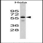 Anti-cell_division_cycle_25_homolog_a_s_pombe_cdc25a_middle_region_antibody_original_ap13255pu-n-004