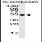 anti-Cell Division Cycle 25 Homolog A (S. Pombe) (CDC25A) (Ser78) antibody