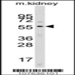anti-Cell Division Cycle 25 Homolog A (S. Pombe) (CDC25A) (N-Term) antibody