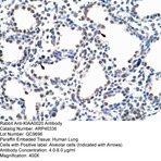 Anti-kiaa0020_kiaa0020_n-term_antibody_original_arp40336-qc9696-ihc-image-01