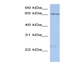 Anti-kiaa0020_kiaa0020_n-term_antibody_original_arp46213-qc22905-wb-image-01