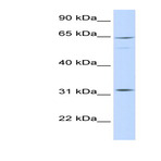Anti-rho_gtpase_activating_protein_25_arhgap25_middle_region_antibody_original_arp58423-qc25808-wb-image-01