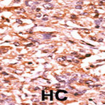 anti-Cell Division Cycle 25 Homolog B (S. Pombe) (CDC25B) (pSer187) antibody