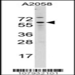 Anti-cell_division_cycle_25_homolog_b_s_pombe_cdc25b_n-term_aa_165-194_antibody_original_ap7256d