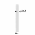 anti-Deleted in Liver Cancer 1 (DLC1) (AA 47-249) antibody