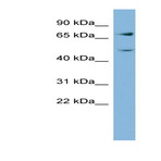 Anti-glutamine-fructose-6-phosphate_transaminase_2_gfpt2_middle_region_antibody_original_arp42215-qc12775-wb-image-01