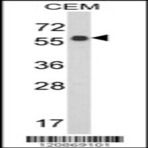anti-WD Repeat Domain 1 (WDR1) (C-Term), (AA 548-577) antibody