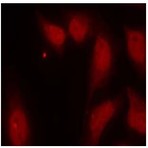 anti-Cell Division Cycle 25 Homolog C (S. Pombe) (CDC25C) (Ser216) antibody