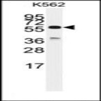 anti-Cell Division Cycle 25 Homolog C (S. Pombe) (CDC25C) (C-Term) antibody