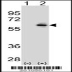anti-Cell Division Cycle 25 Homolog C (S. Pombe) (CDC25C) antibody
