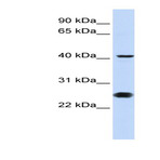 anti-Cell Division Cycle 25 Homolog C (S. Pombe) (CDC25C) (N-Term) antibody